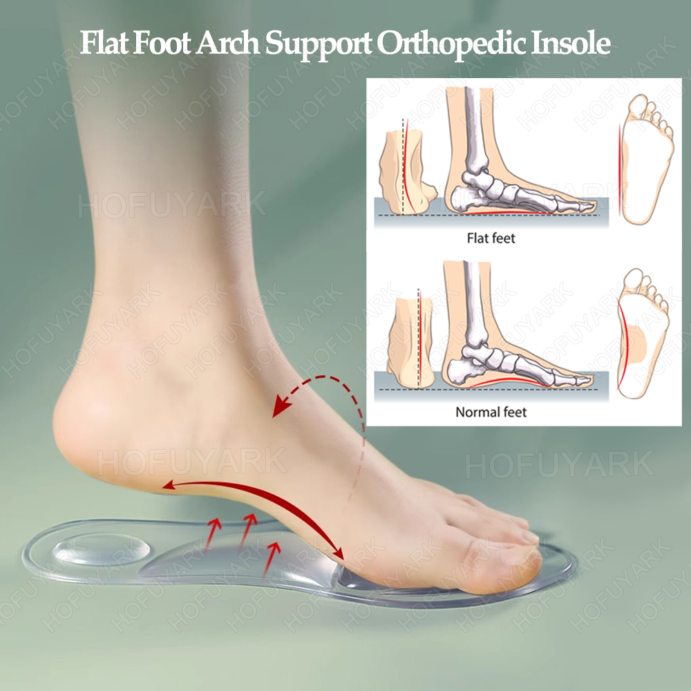 Silicone Gel Insoles Orthopedi - Women'S Shoes High Arch Support ulasan dan harga