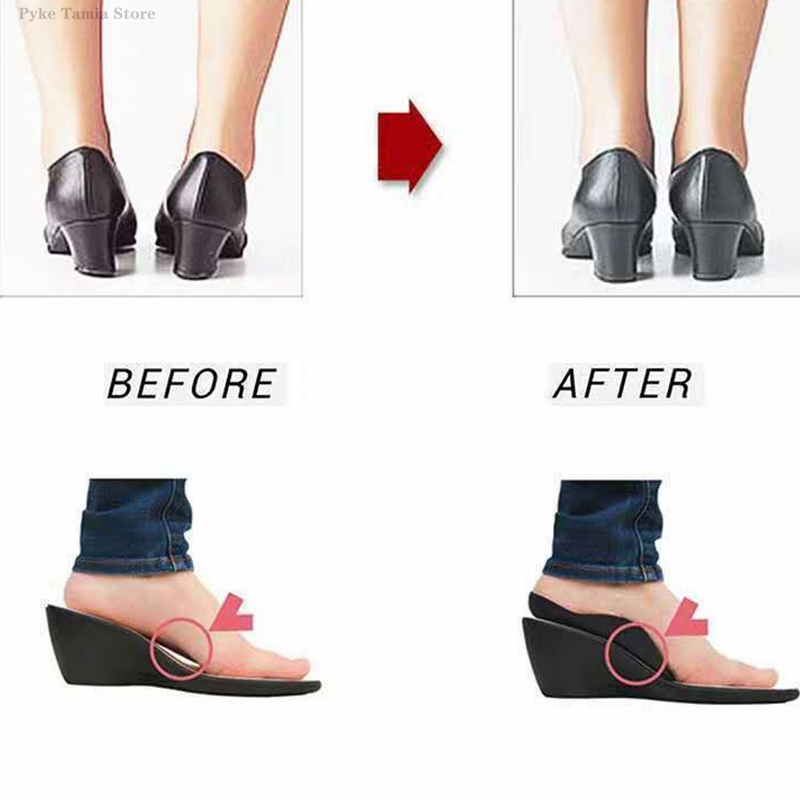 1Pair Flat Feet Insoles Orthot - Women'S Shoes For Plantar Fasciitis ulasan dan harga